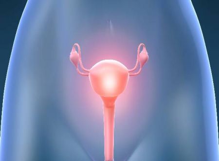 Ovarian Cyst Diagnosis and Treatment